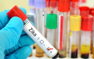 Determinação da ANS obriga planos de saúde a oferecerem exames de zika